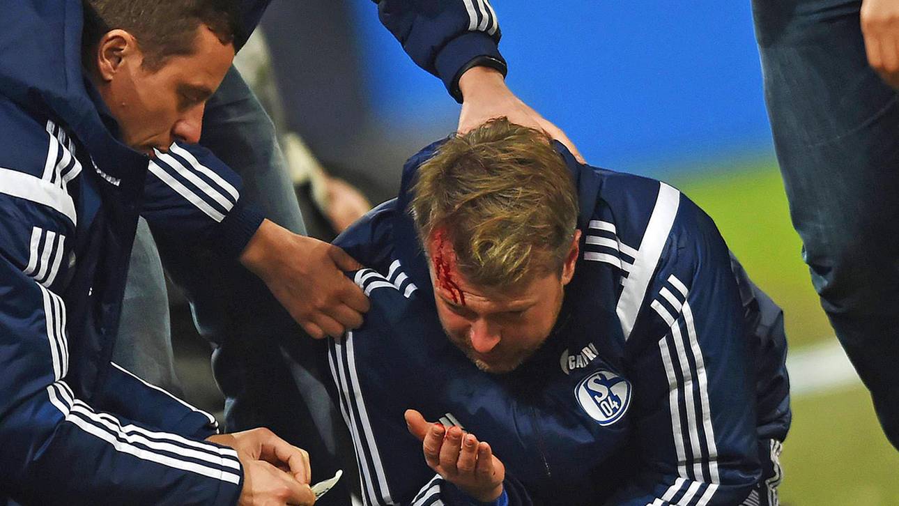 Feuerzeug-Eklat überschattet S04-Pleite