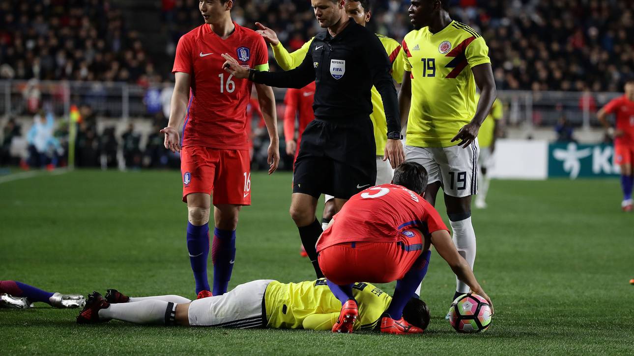 James mit übler Schauspieleinlage