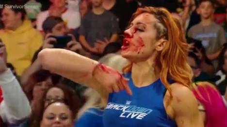 Becky Lynch zog sich bei WWE Monday Night RAW eine heftig blutende Platzwunde zu