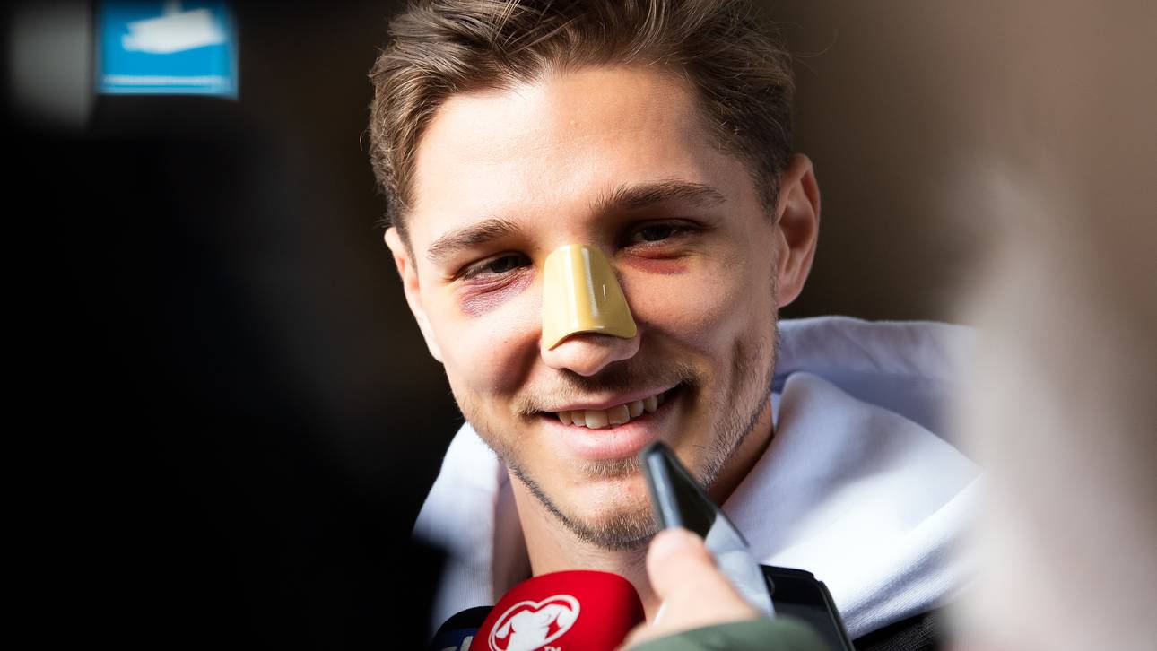 Verletzter Stark heiß auf DFB-Debüt