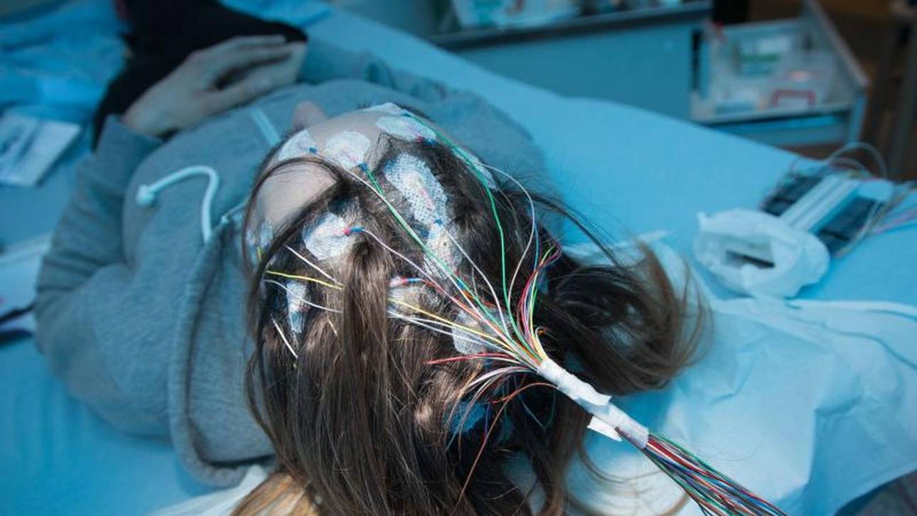 Schlafmangel kann Epilepsie auslösen