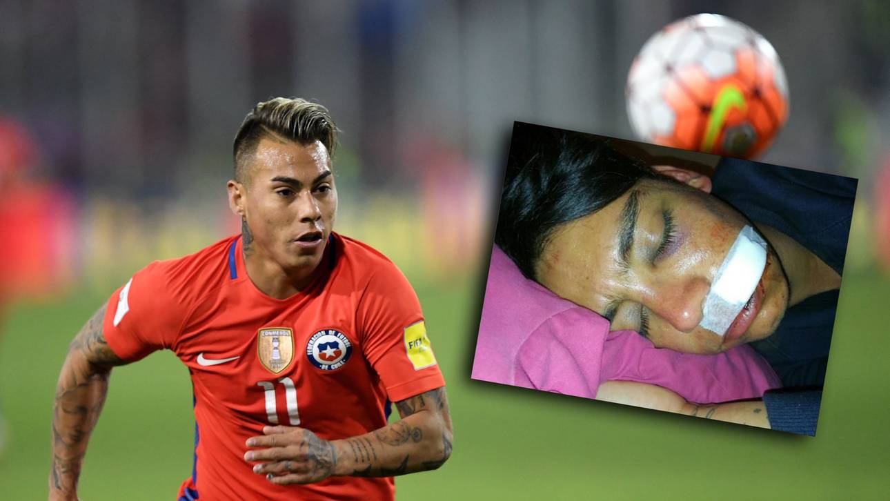 Vargas-Bruder von Polizei verprügelt?