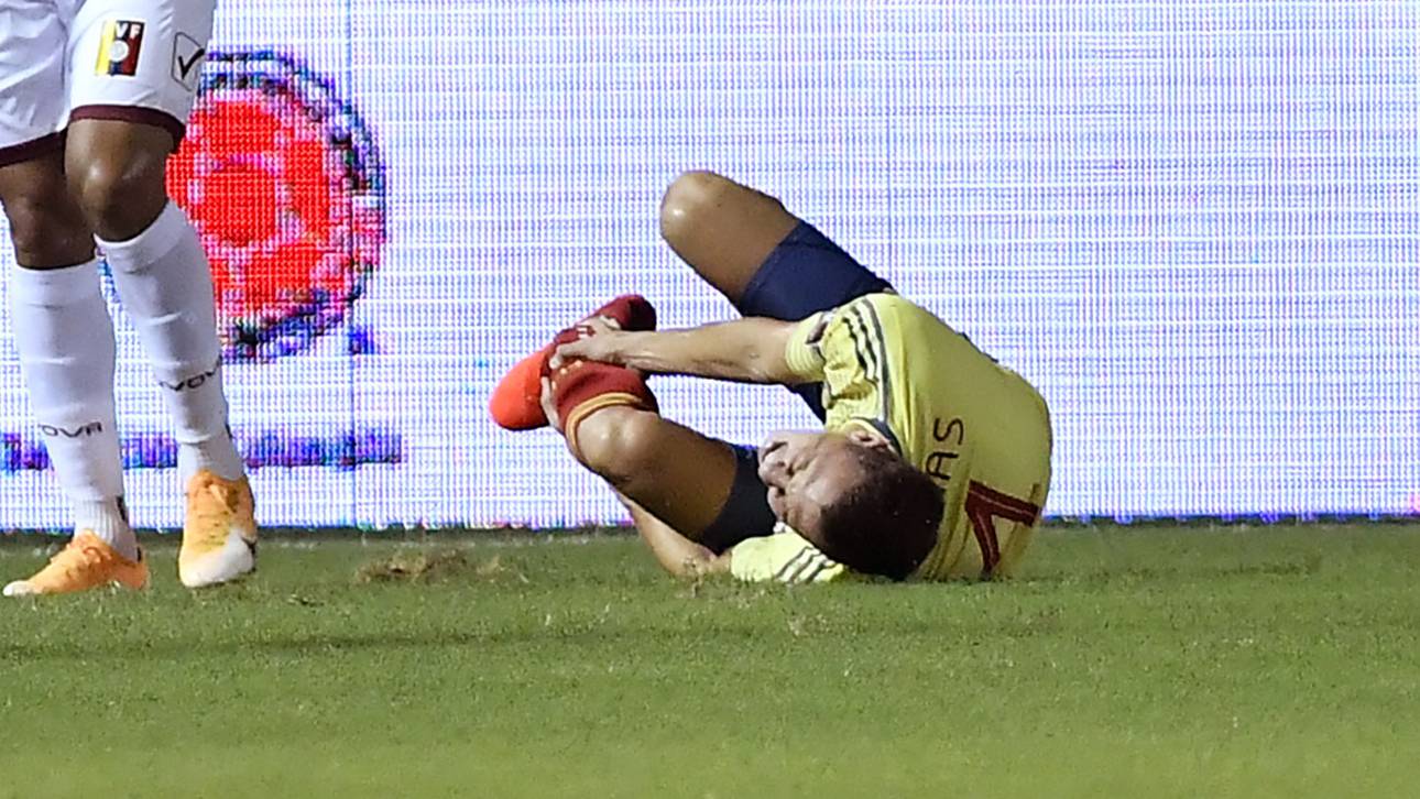 Arias fehlt Leverkusen lange