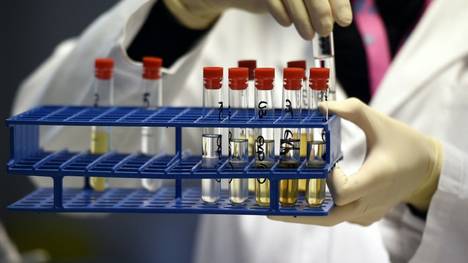 Der DAV fordert weitere Maßnahmen zur Dopingsbekämpfung