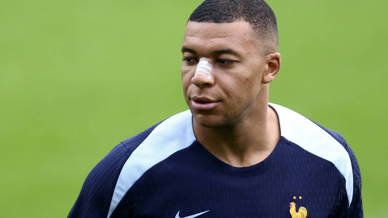 Mbappé trainiert mit Nasenpflaster