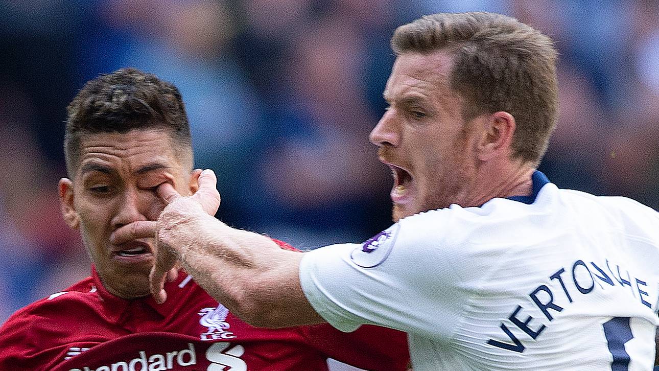 Firmino: So steht es um mein Auge