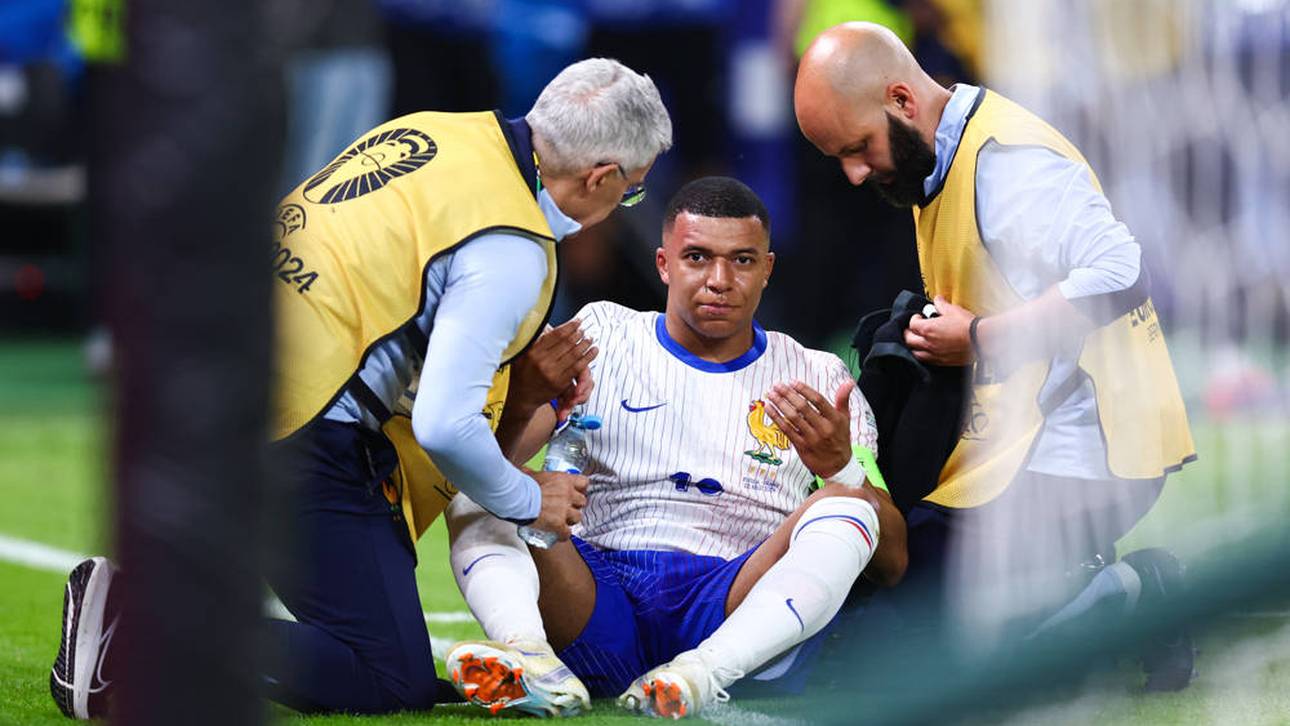 Kylian Mbappé bekam aus kurzer Distanz den Ball an den Kopf und musste an seiner lädierten Nase behandelt werden