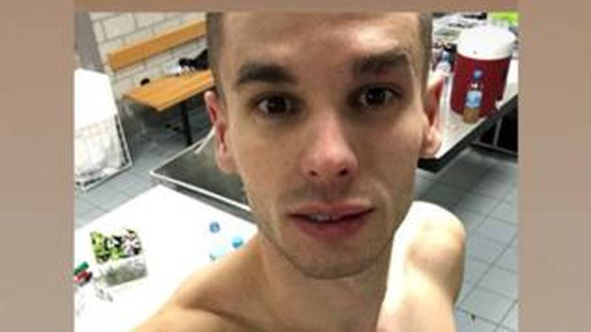 Mijat Gacinovcs Bruder postete ein Bild von den Verletzungen des SGE-Akteurs auf Instagram
