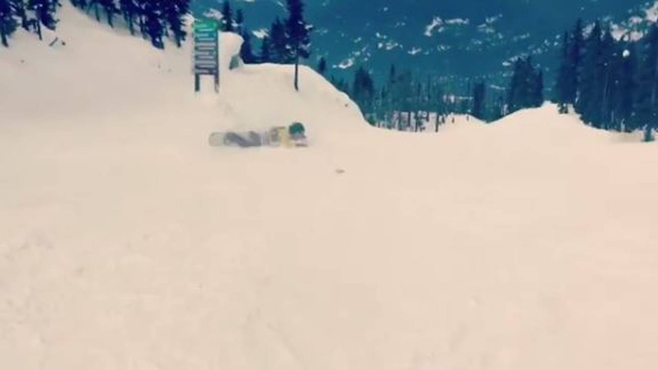 Beckham zeigt Knochenbruch-Video