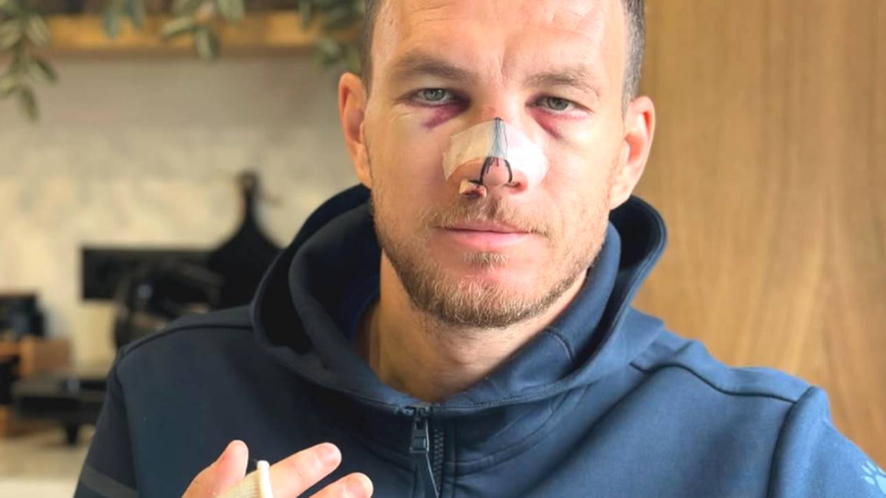 Ex-Bundesliga-Star übel zugerichtet