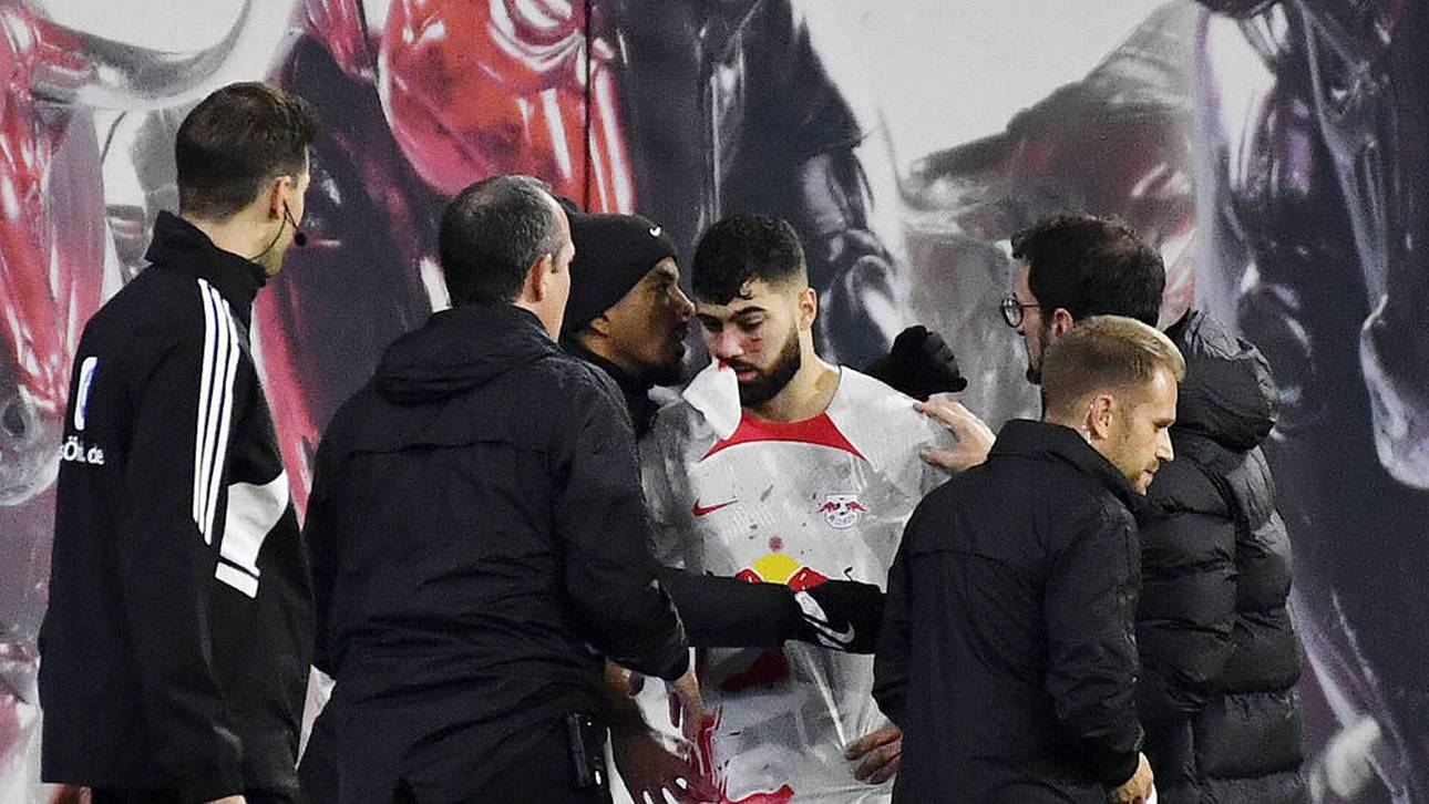 Diagnose bei RB-Star nach Blut-Crash