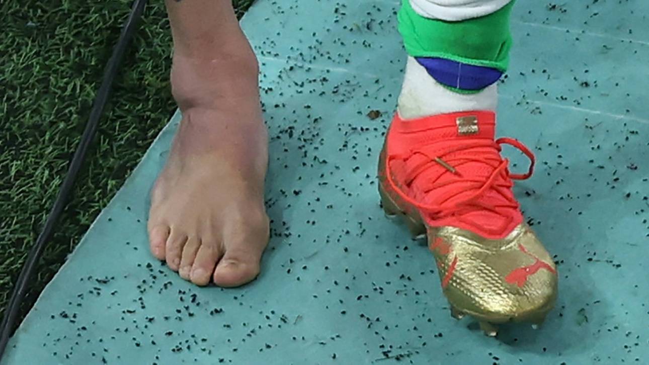 Neymars Knöchel verstaucht – weitere Untersuchungen folgen