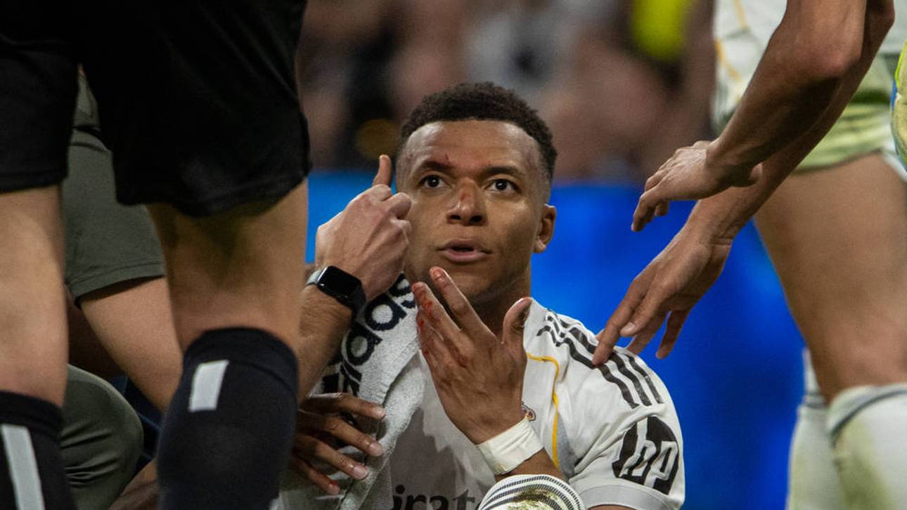 Mbappé-Ausfall sorgt für Verwirrung