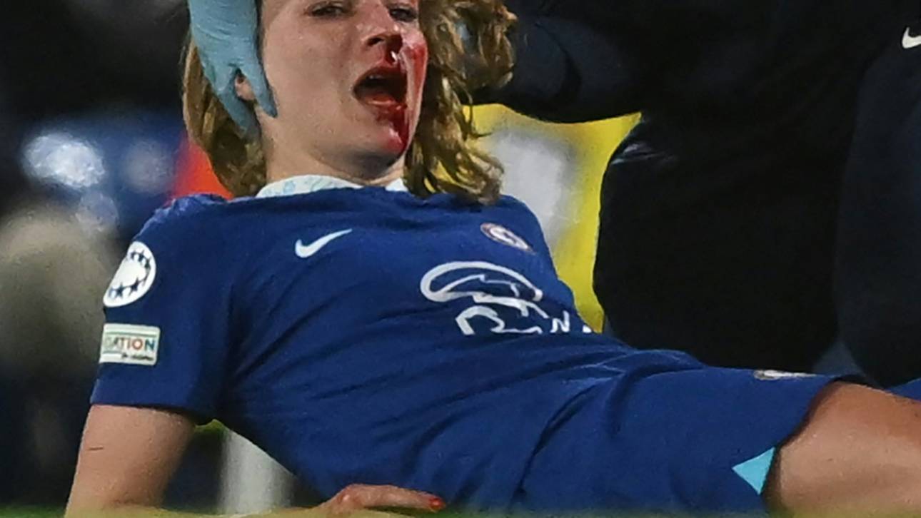 Leupolz mit Maske? DFB optimistisch