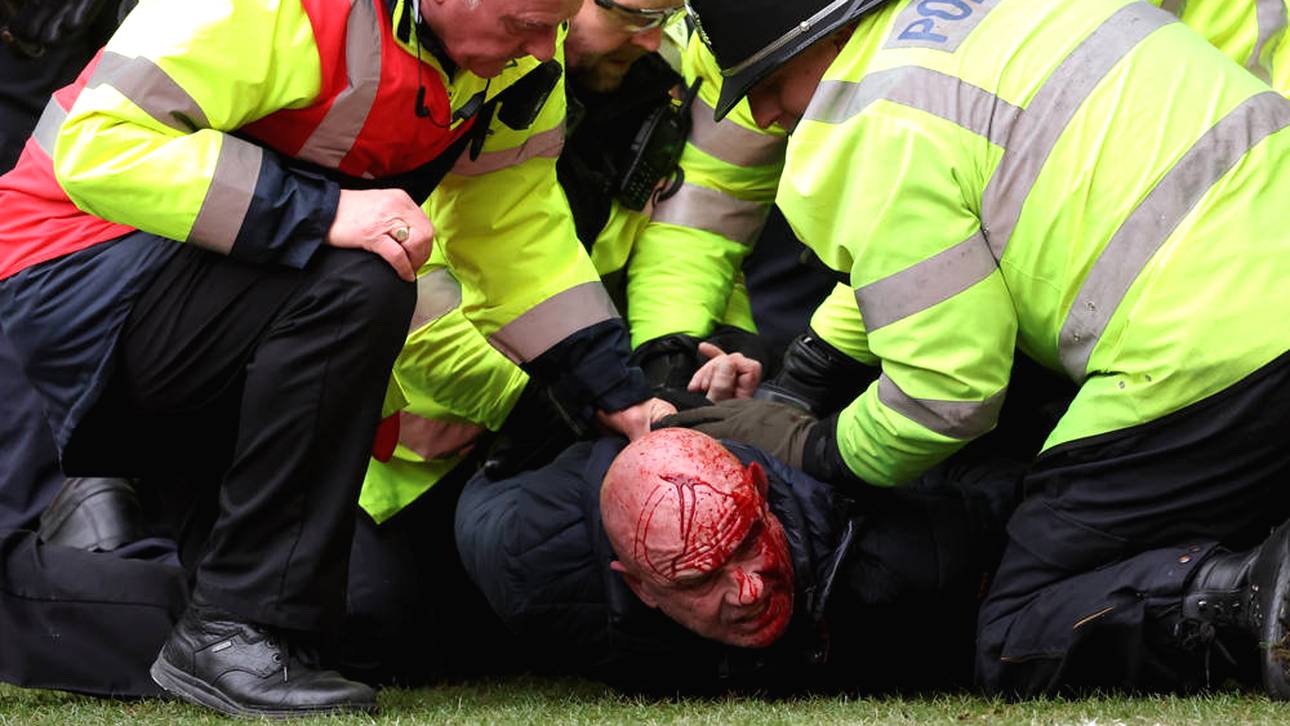 Blutige Krawalle bei England-Derby