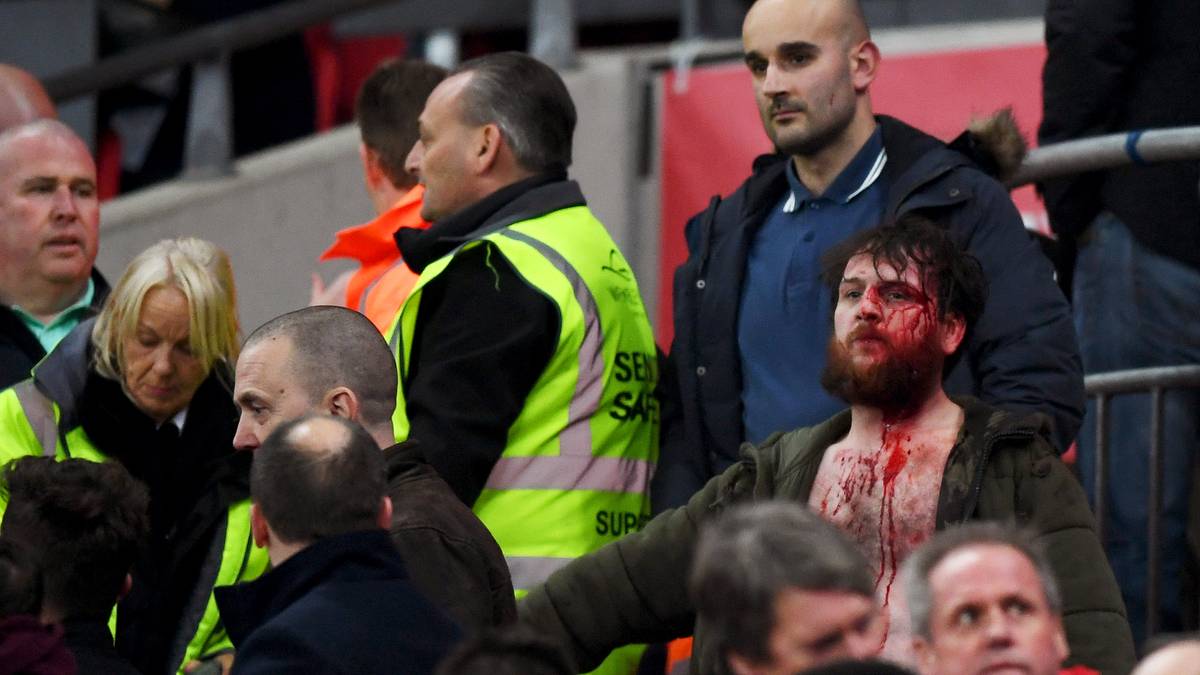 Auf der Tribüne wird es derweil blutig