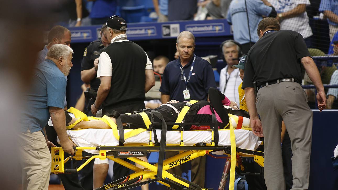 MLB-Fan von Ball im Gesicht getroffen