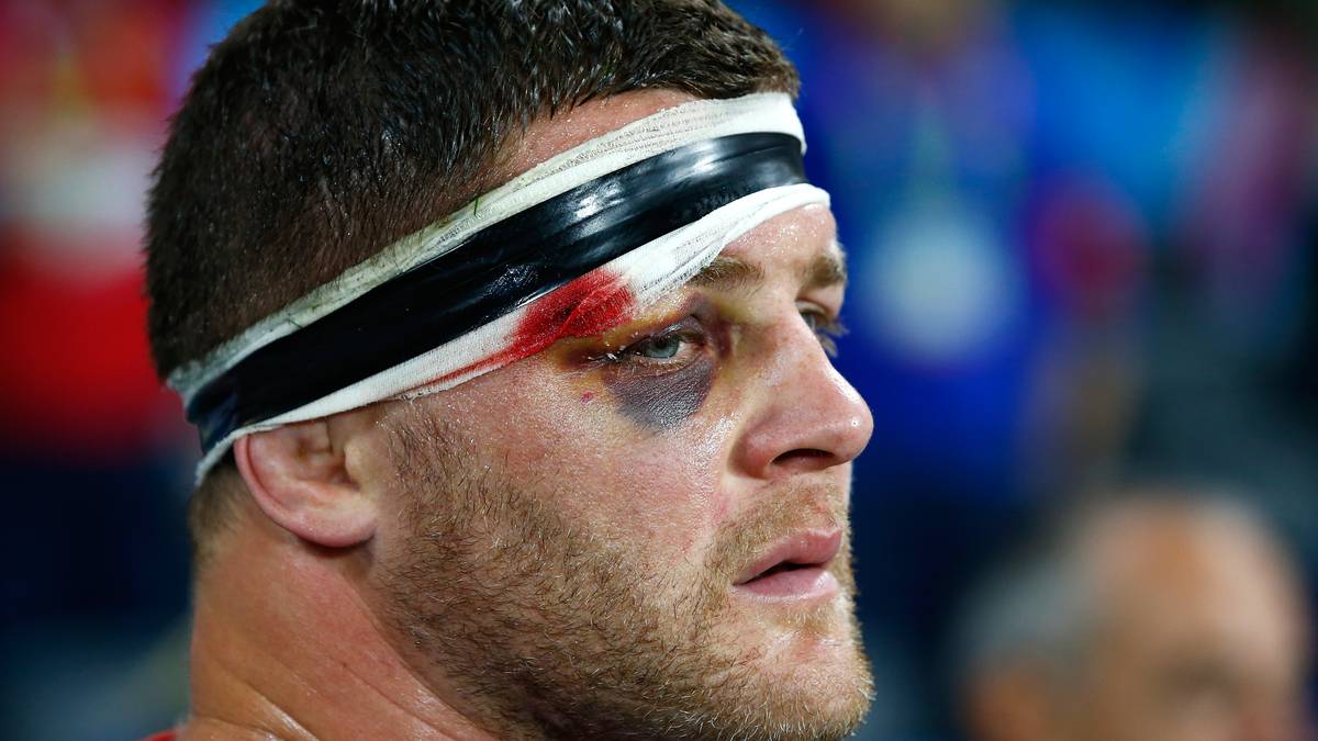 Nichts für Weichlinge. Benjamin Kayser aus Frankreich hat schon etwas Farbe im Gesicht bekommen