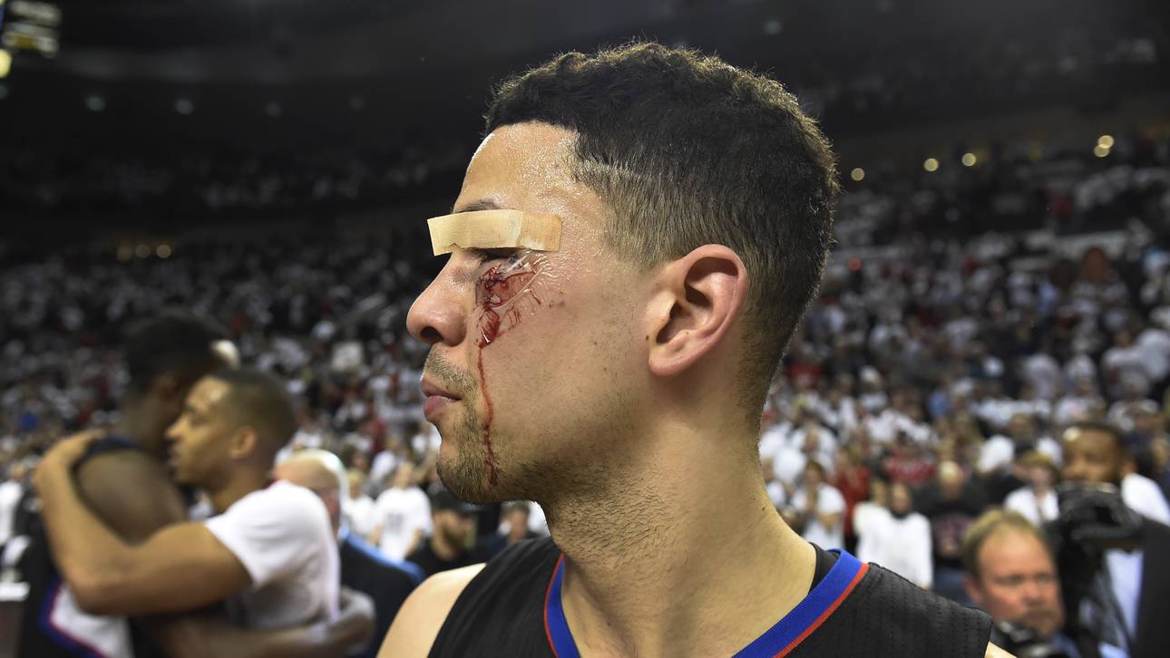 Austin Rivers musste mit elf Stichen genäht werden