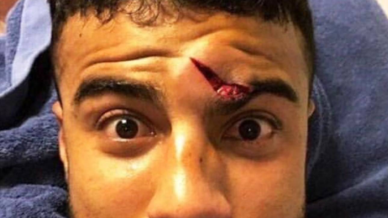 Ter Stegen verursacht Horror-Beule