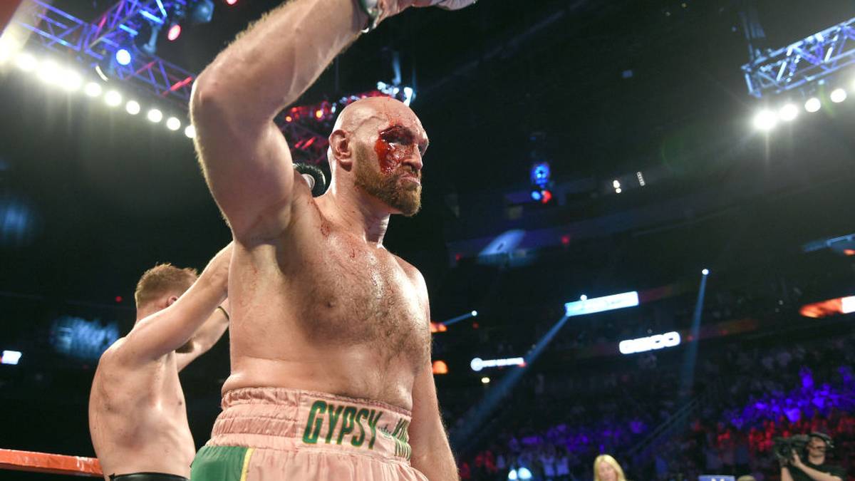 Trotzdem ist das Fazit für Fury positiv: Er bleibt unbesiegt, hat dem US-Publikum eine große Show geliefert und kann sich in Richtung eines WM-Fights mit Deontay Wilder oder dem Sieger des Ruiz-Joshua-Rückkampfs orientieren