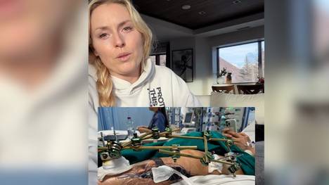 Nach ihrer schweren Verletzung hat sich Lindsey Vonn nach der Entlassung aus dem Krankenhaus zu Wort gemeldet.