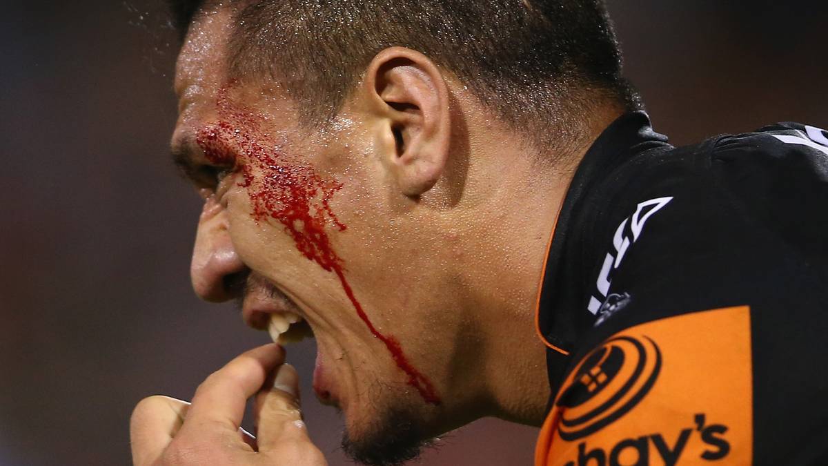 Über Schwalben der Fußballer können Rugby-Spieler nur lachen. Man sollte Blut sehen können oder mit verlorenen Zähne klar kommen