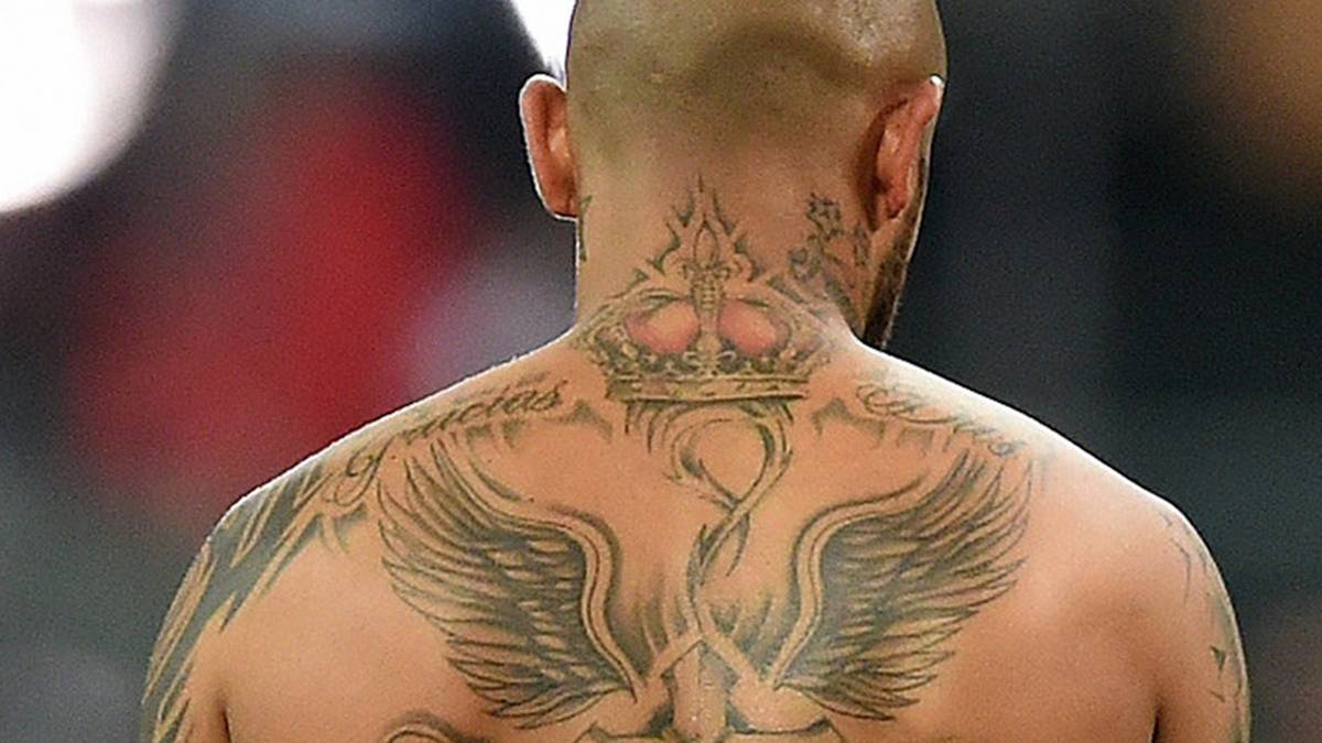 So "leer" sah der Rücken von Ex-Bayern-Star Arturo Vidal noch im vergangenen Jahr aus. Inzwischen ist er kaum wieder zu erkennen