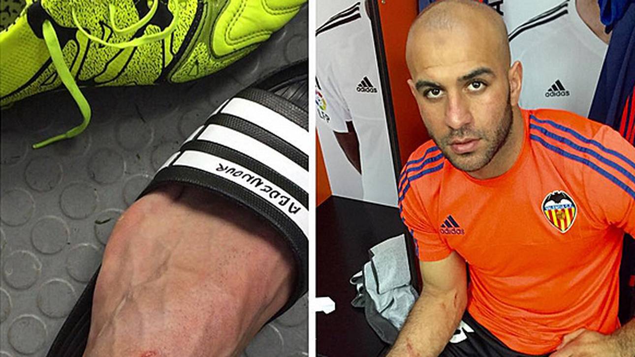 Ex-Bremer von Suarez gezeichnet