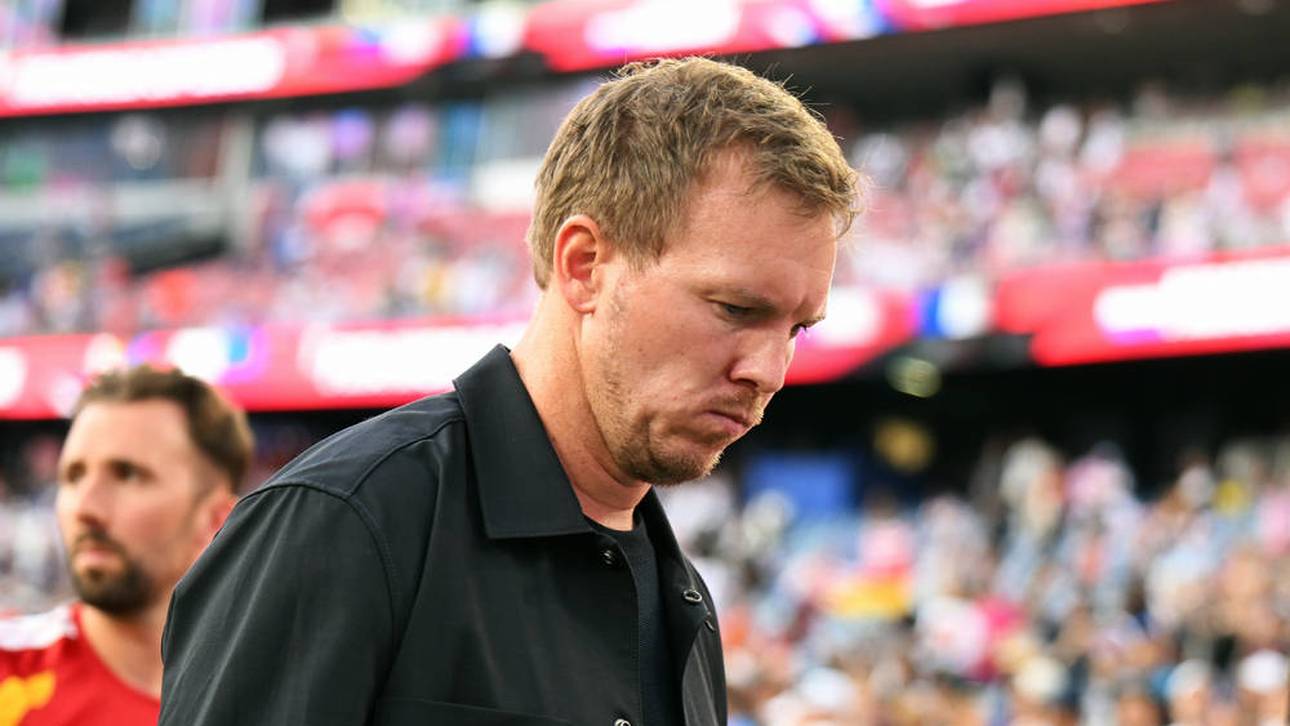 Ist Nagelsmann nun verbrannt?