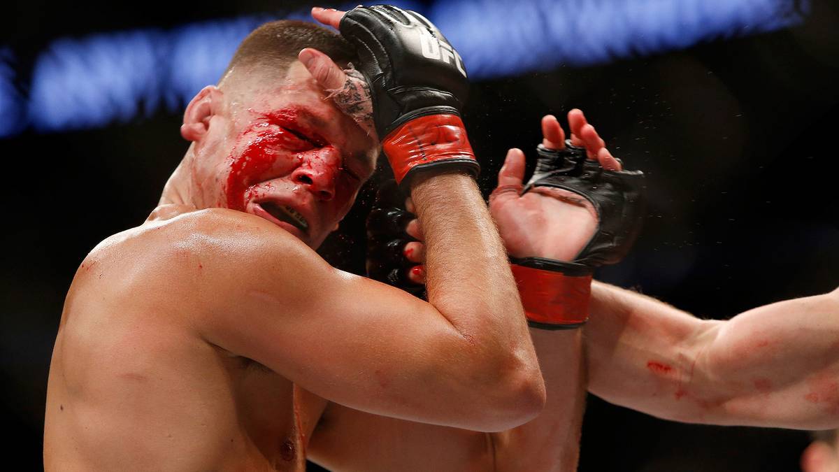 Doch dann kassiert er einen Hagel aus Schlägen, die mehrere Cuts in seinem Gesicht hinterlassen