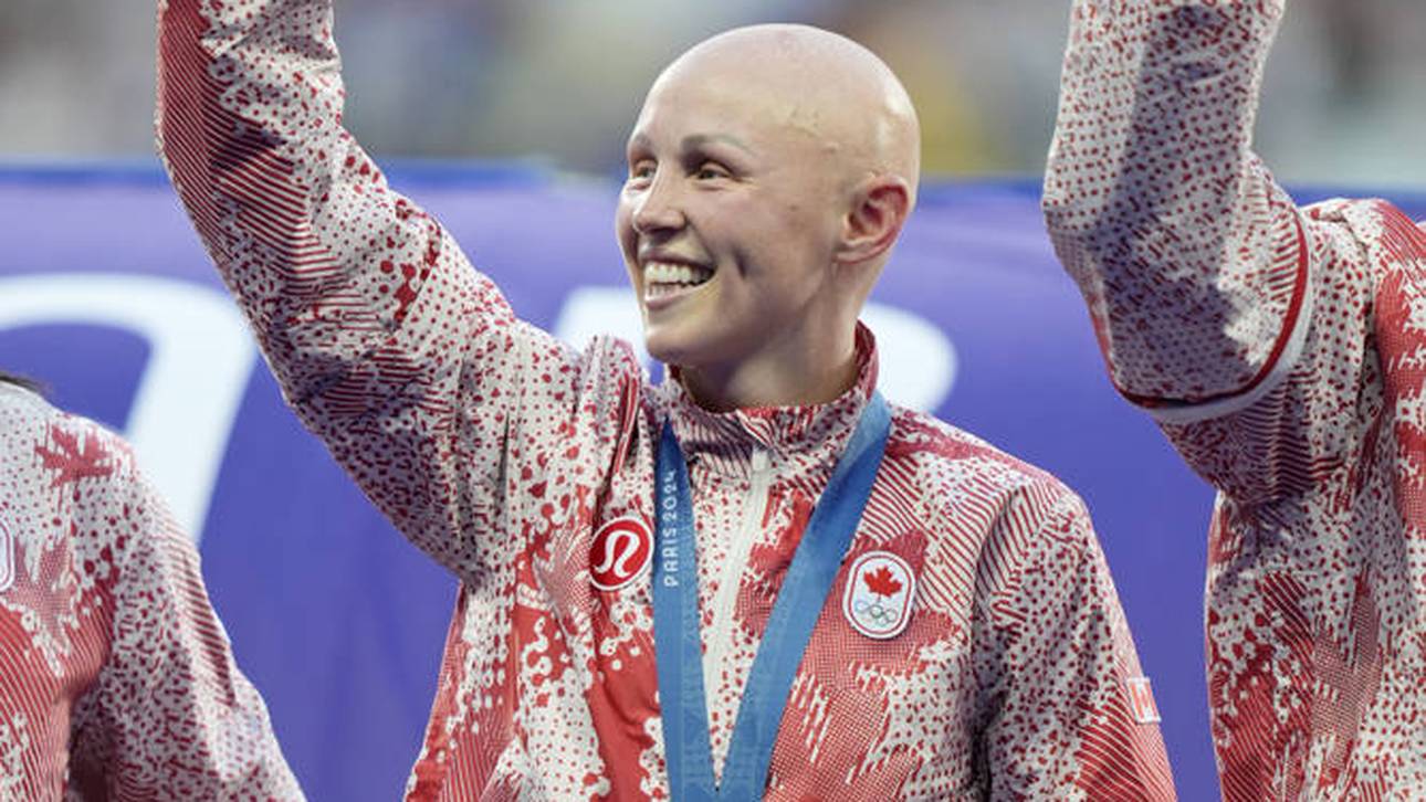 Olympia-Heldin verlor Haare mit 7