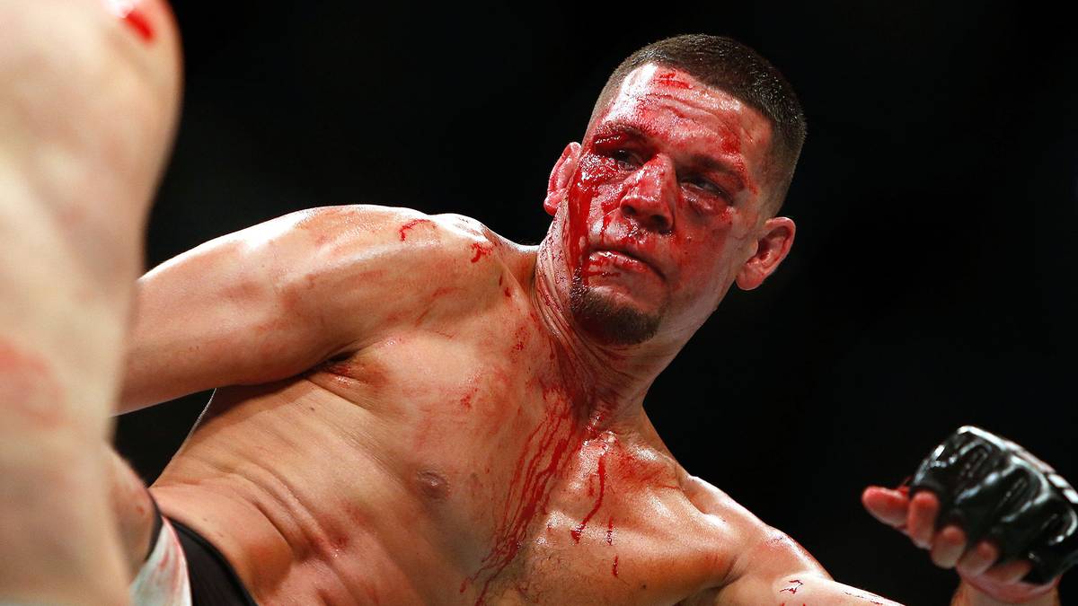 Diaz gibt nicht auf und versucht es auch mit krachenden Kicks