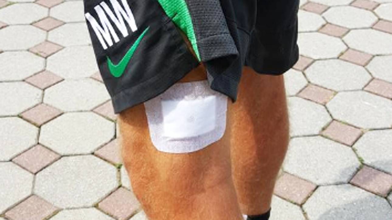 Markus Weinzierl von Zecke gebissen