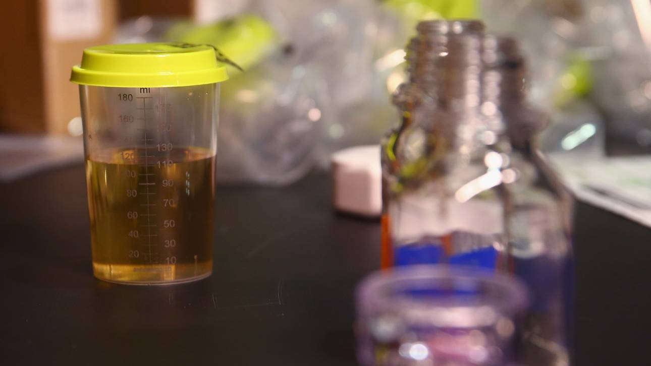 Doping: Eklatante Mängel in fünf Ländern