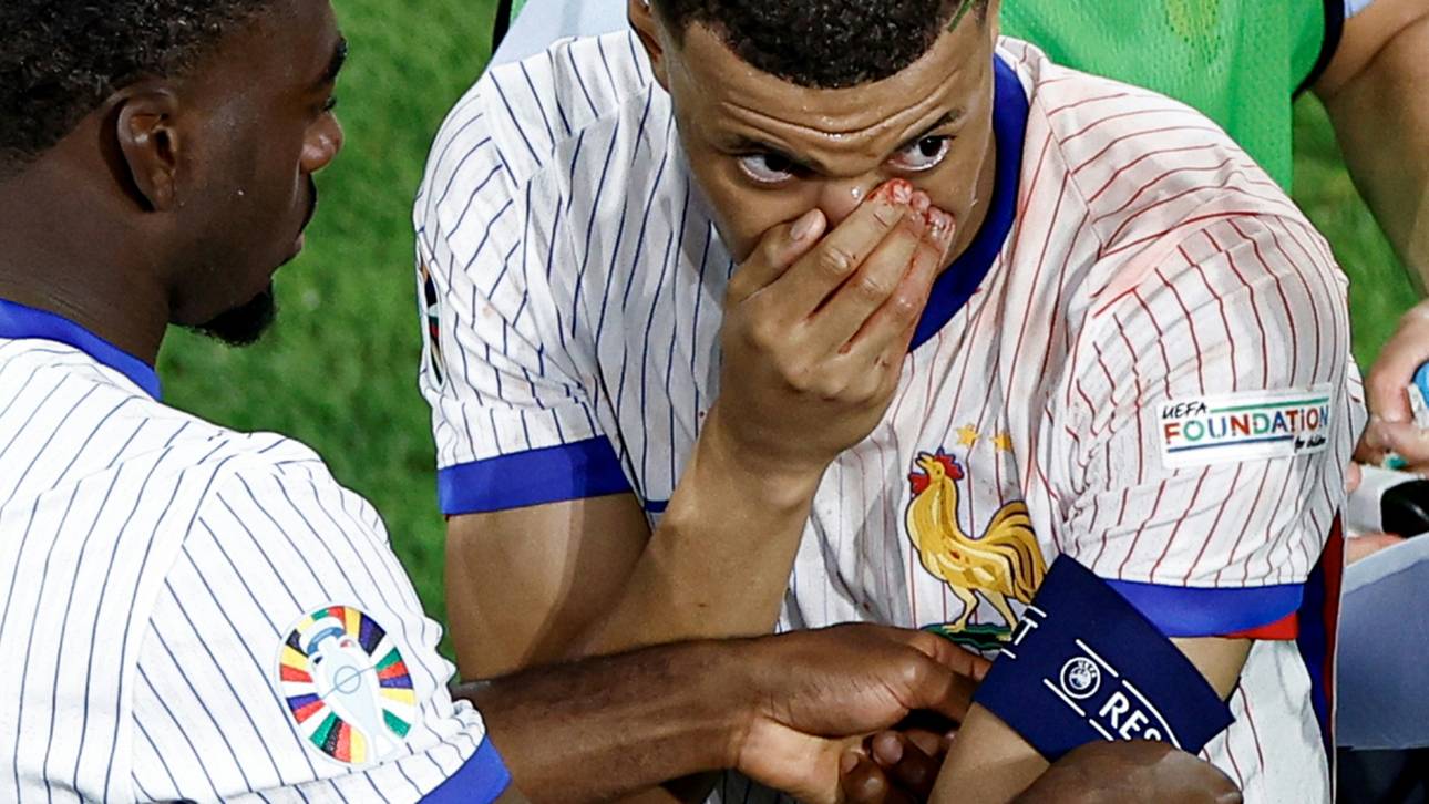 FFF: Mbappe-Einsatz bleibt „unsicher“ – Update am Mittwoch