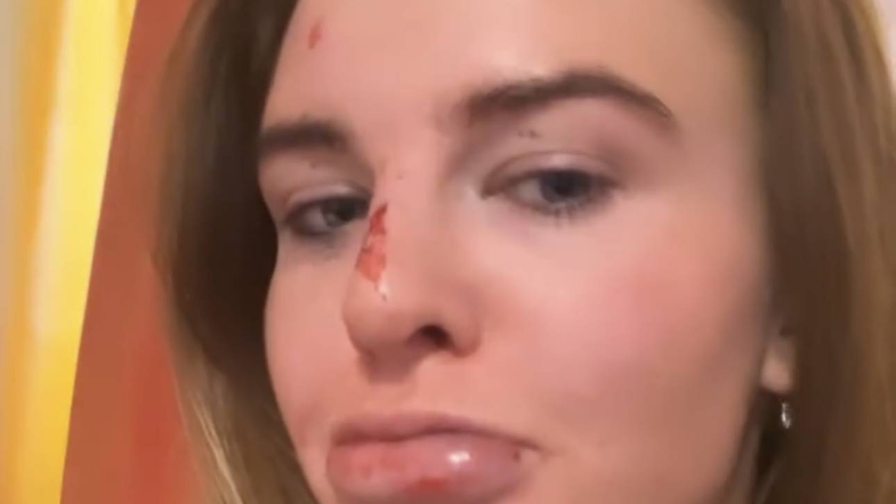 Ski-Star scherzt über Verletzung