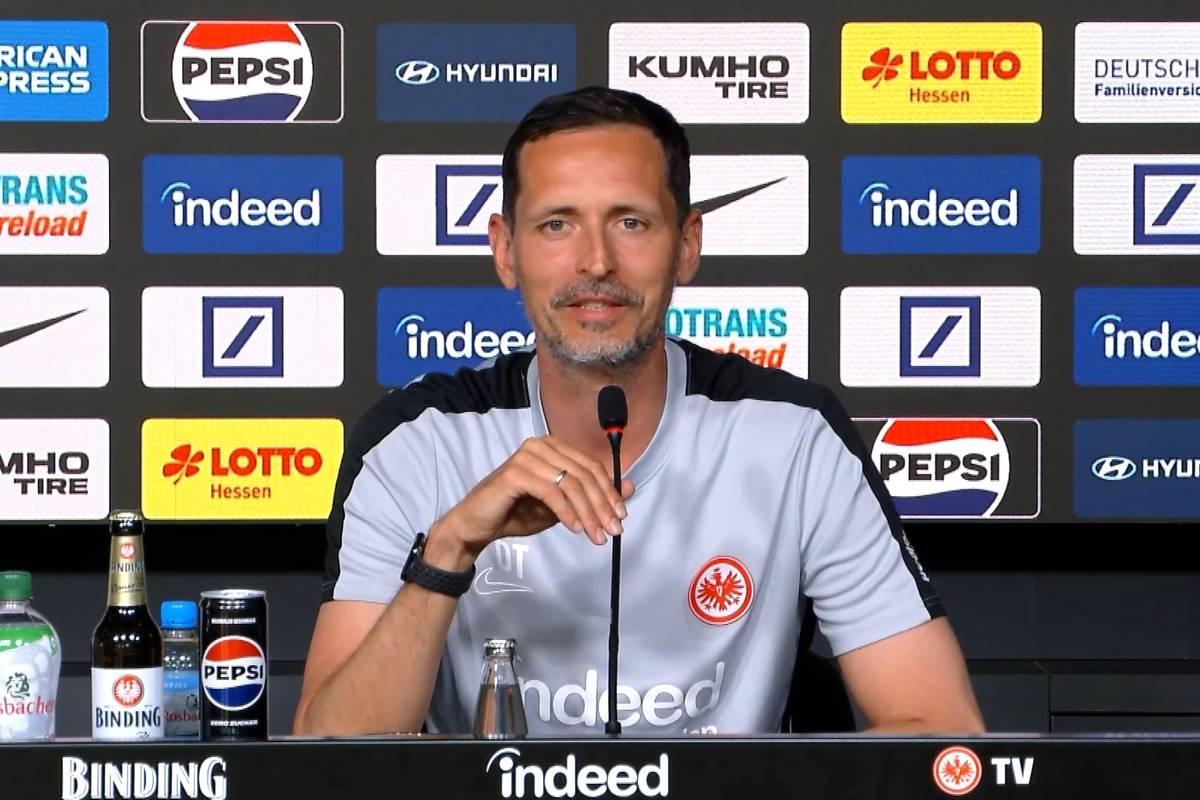 Eintracht-Trainer Dino Toppmöller wurde gefragt, ob es weh getan habe, den Halbfinalisten in der Europa League zuzuschauen?