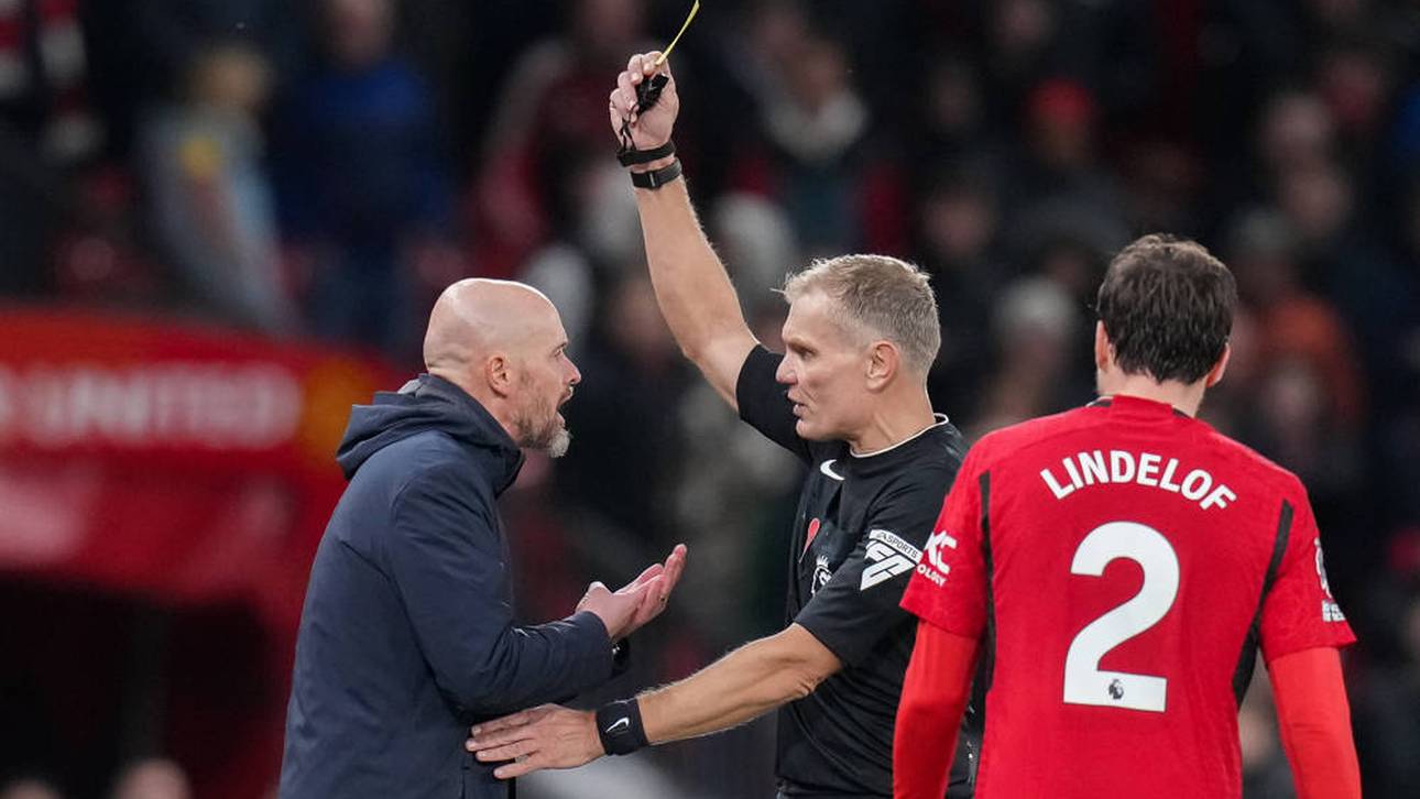 Nächster Rückschlag für ten Hag