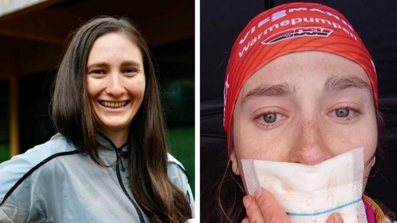 Zungen-Transplantation bei Biathletin