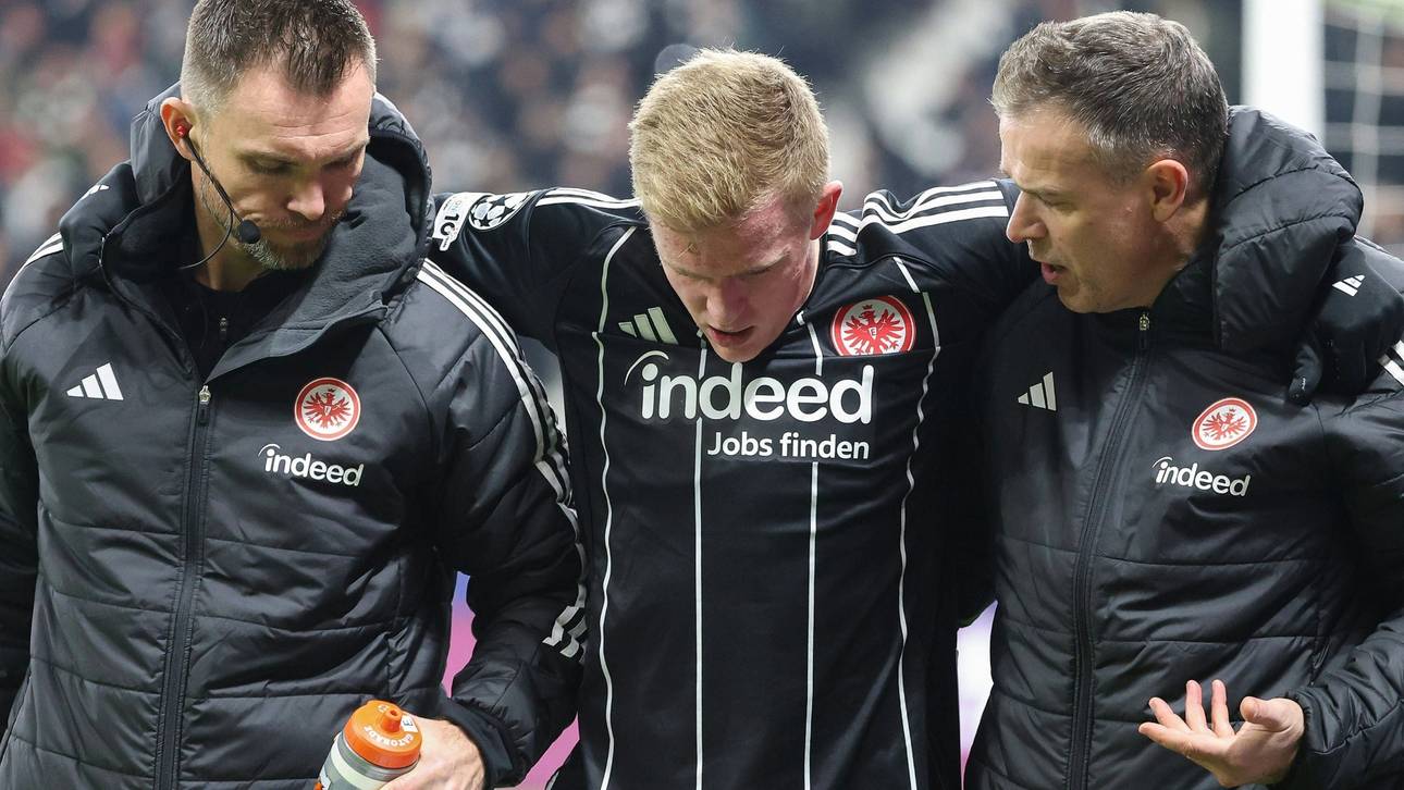 Toppmöller sieht Burkardt-Alternativen