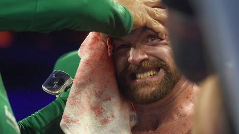Tyson Fury besiegte Otto Wallin nach Punkten