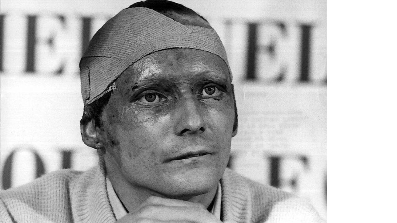 Vom Feuer gezeichnet, vom Mut geprägt