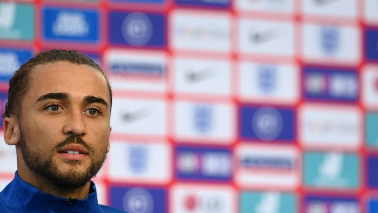 Everton-Profi Calvert-Lewin sorgt mit ungewöhnlichem Outfit für Aufsehen