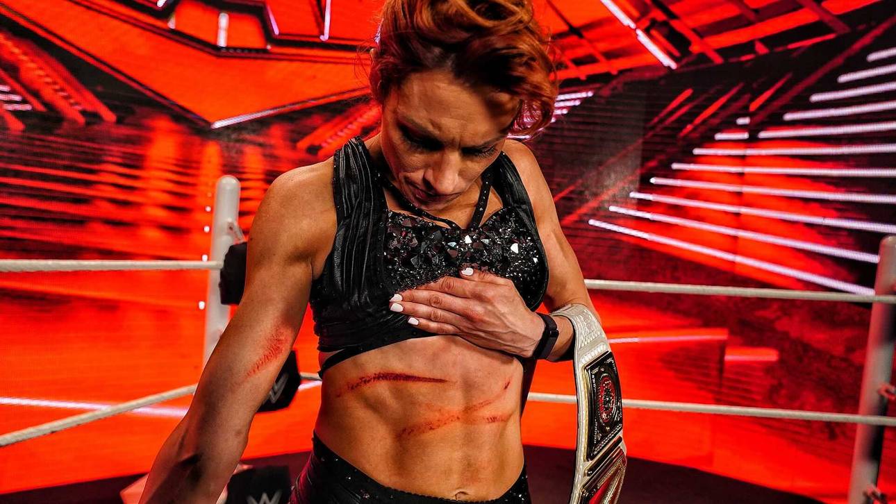 WWE-Star fängt sich üble Wunden ein
