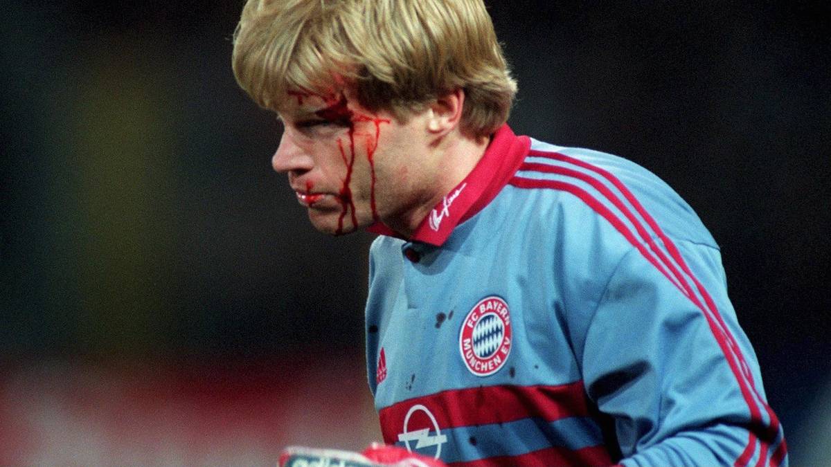 Das ungewöhnliche Wurfgeschoss trifft Kahn am Kopf. Der Titan wird mit zwei Stichen an der Schläfe genäht. Fußball-Deutschland schimpft auf einen 16-jährigen "Golfball-Attentäter"