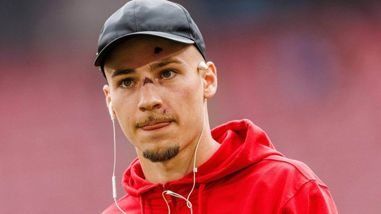 Erlitt Gesichtsverletzungen: Tim Lemperle