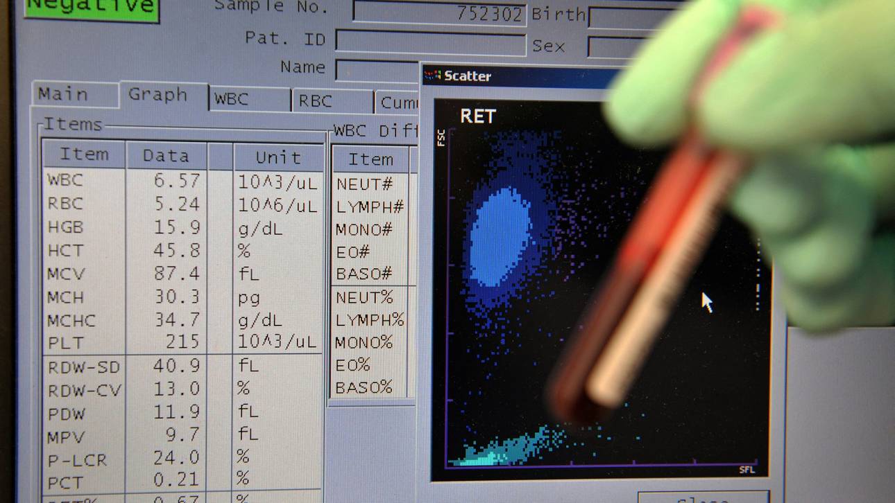 NADA untersucht erstmals digitale Matrix alter Proben