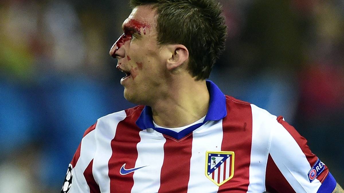 In Madrid fallen keine Tore - dafür fließt Blut. Mario Mandzukic sieht nach einem Ellbogen-Check schwer gezeichnet aus. 