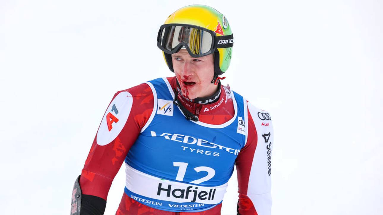 Ski-Star schlägt sich Zahn aus